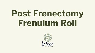 Post Frenectomy Frenulum Roll [upl. by Willin]