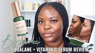 Biossance Squalane  Vitamin C Dark Spot Serum Review 28 Day Challenge Le Beat [upl. by Suidaht]