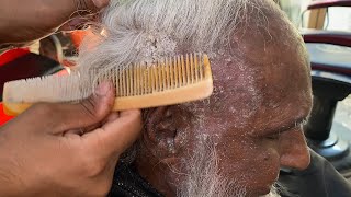 OMG 😳 dandruff scratching 🪮 comb ￼🥵dandruff removal satisfying 💯 [upl. by Elyn]