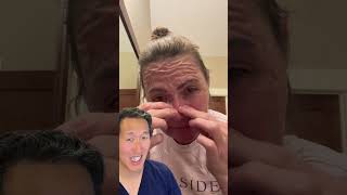 Plastic Surgeon Reacts to DIY Gelatin Face Mask [upl. by Etnasa]