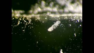 Protists and a bdelloid  rotifer  Raw vid II [upl. by Nadeau]