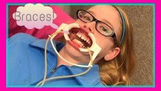 What Getting Braces is Like  Abby Time [upl. by Eecyak]