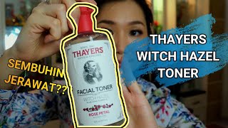 REVIEW THAYERS Witch Hazel Toner  Toner yang katanya ampuh buat kulit berminyak dan berjerawat [upl. by Asiralc]