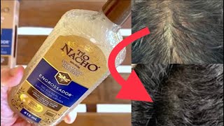 Shampoo Tio Nacho Antiqueda de Cabelo Engrossador de Fio Mais Volume Capilar Ajuda Careca Unboxing [upl. by Ygiaf91]