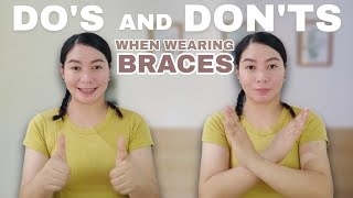 DOS AND DONTS WHEN WEARING BRACES  MGA DAPAT GAWIN AT IWASAN PAG NAKA BRACE KA [upl. by Yrahca]