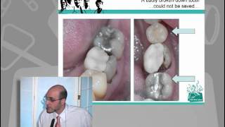 JGH MiniMed School  Dr Samer Abi Nader To Implant or not to Implant That is the Question [upl. by Ambrose]