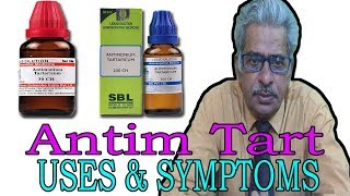 Anitim Tart  Uses amp Symptoms in Homeopathy by Dr PS Tiwari [upl. by Ahsiad519]