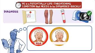 MyEMCert Key Advance  Outpatient Treatment for Pulmonary Embolism [upl. by Nannah]