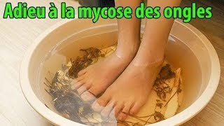 Adieu à la mycose des ongles avec ces méthodes de traitement naturel  conseils [upl. by Nadabb]