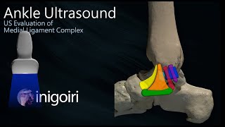 ANKLE US MEDIAL LIGAMENT COMPLEX EVALUATION [upl. by Eanrahc]