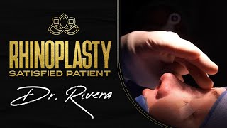 Patient is satisfied with her Rhinoplasty results by Dr Rivera at Vive Plastic Surgery [upl. by Niatsirhc]