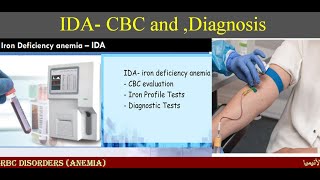 Lecture 132 IDA  CBC and Diagnosis [upl. by Danyette]