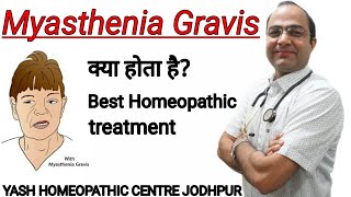 Myasthenia Gravis  माईस्थेनिया ग्रेविस का इलाज । [upl. by Airehtfele]