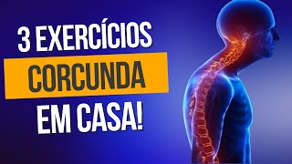 3 Exercícios pra CORRIGIR A CORCUNDA  Hipercifose Torácica [upl. by Naux]