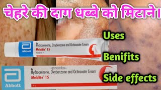 Melalite 15 Cream Benifits  Use  Side effects  Full Review in Hindi [upl. by Ahsienauq]