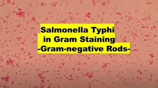 Salmonella Typhi in Gram stained smear of culture Microscopy at various magnifications [upl. by Macrae]