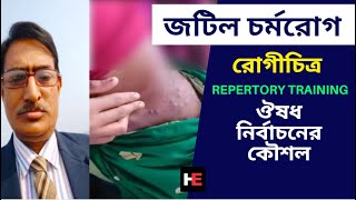 জটিল চর্মরোগ  ঔষধ নির্বাচনের কৌশল  Skin Disease  Dr Rabin Barman  HomeoExpress [upl. by Sanborn860]