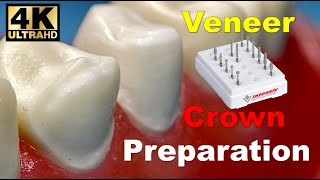 Veneer and Crown Prep StepbyStep [upl. by Granniah]