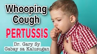 Whooping Cough Pertussis Causes Symptoms amp Treatment  Dr Gary Sy [upl. by Yseult]