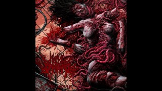 Agonal Breathing  Brutalized Esophageal Remains [upl. by Goddord]