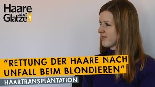 Nach Verätzung beim Blondieren Haarverpflanzung rettete die Haare [upl. by Atiken363]