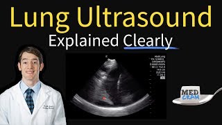 Lung Ultrasound Explained Point of Care Bedside Clinical [upl. by Sible]