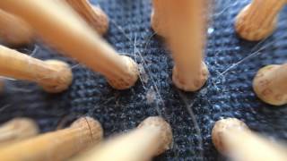 Head louse crawling on hairbrush [upl. by Lion371]