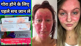 सभी क्रीम की सच्चाई सुन कर हैरान हो जाओगे  Clinskin Cream  Skinshine Cream  Clearskin Cream [upl. by Eenet629]