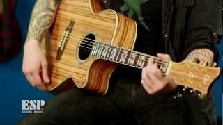 ESP Guitars Guitar of the Week  LTD Xtone Exotic Wood Acoustics [upl. by Leupold927]