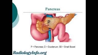 MRCP Radiologist Explains Magnetic Resonance Cholangiopancreatography [upl. by Aihsar]