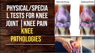 PhysicalSpecial Tests For Knee Joint  Knee Pain  Knee Pathologies  PhysiotherapyKnowledge [upl. by Asselam]