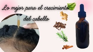 REMEDIO CASERO PARA CRECER EL CABELLO MÁS RÁPIDO [upl. by Durning]