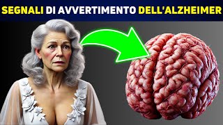 SCIENTIFICO Queste 5 Abitudini Sono Legate allAlzheimer [upl. by Odama]