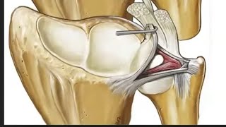 Distal RadioUlnar Joint and Triangular FibroCartilage Complex [upl. by Newcomb363]