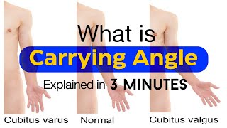 Carrying Angle Explained by Dr Mitali Yadav MamPT  Timesphysio [upl. by Halda]