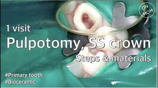 1 visit pulpotomy SS crown steps amp materials [upl. by Peadar847]