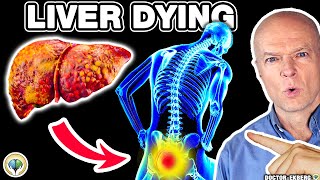 10 Weird Signs You Already Have LIVER DAMAGE [upl. by Ikcaj]