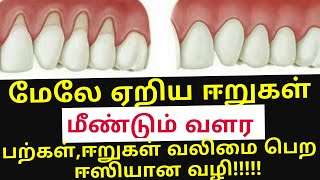 ஈறுகள் மேலே ஏறி அசிங்கமாக உள்ளதா Receding gums home remedy [upl. by Atnuahs]