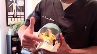 Exertional Compartment Syndrome  Dental Retainer  NeuroCentric Chiropractic [upl. by Lahsiv]