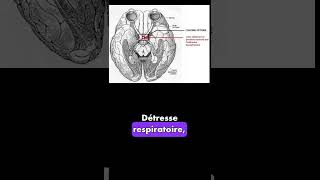 Mots science médicale [upl. by Dareen]