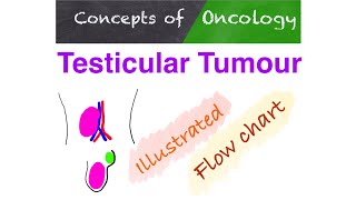 Testicular Tumours [upl. by Yrrek821]