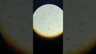 Widal test positive  widal T H positive 180 agglutination microscopic view  widaltest widal [upl. by Oiragelo]