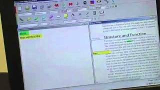 Assistive Software Demo ZoomText JAWS and Dragon [upl. by Hendrik]