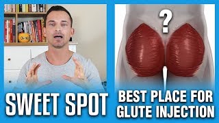 Best Place For Glute Injection  The Sweet Spot [upl. by Lesig968]