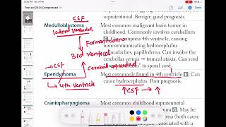 Ependymoma neurology 132  First Aid USMLE Step 1 in UrduHindi [upl. by Deevan]