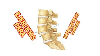 Ejercicios para RETROLISTESIS LUMBAR [upl. by Nidnarb]