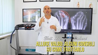 Alluce Valgo Alcuni consigli e alternative su come trattarlo [upl. by Adella495]