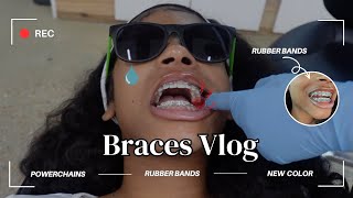 BRACES VLOG  NEW COLOR  POWER CHAINS  I GOT RUBBER BANDS 😁✨ [upl. by Dene]