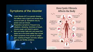 Cystic fibrosis recording [upl. by Hagood459]