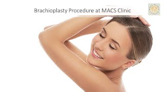 Steps involved in Brachioplasty Procedure performed at MACS Clinic [upl. by Burrow]